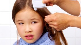 حذار من قمل الشعر!