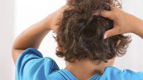 تحيا القمل!