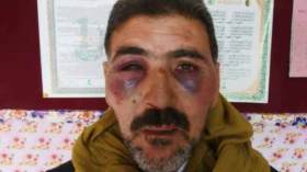 ولي تلميذة وشقيقها يقتحمان ابتدائية ويعتديان على أستاذ بتبسة