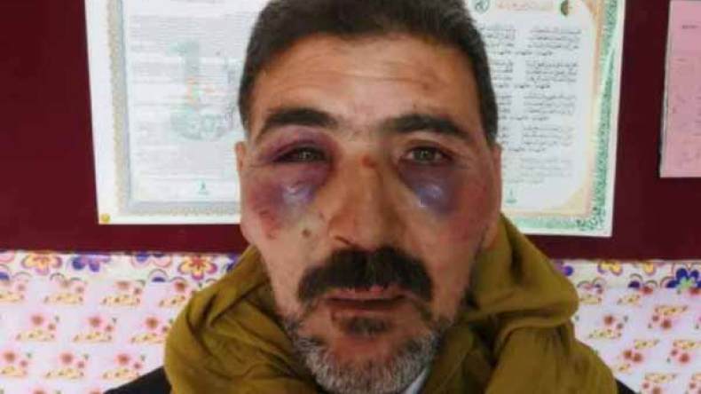 ولي تلميذة وشقيقها يقتحمان ابتدائية ويعتديان على أستاذ بتبسة