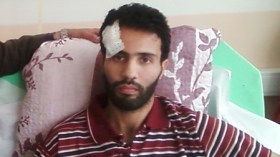 حالتي تحسنت كثيرا وسأستأنف التدريبات بعد أكثر من شهر