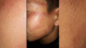 أستاذ رسم يعتدي بالضرب على تلميذ ويشوه وجهه بسكيكدة