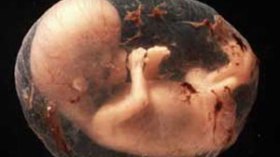 تدخين الام مرتبط بالتشوهات الخلقية بالفم لدى المواليد