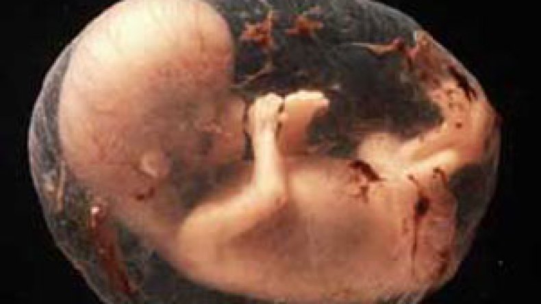 تدخين الام مرتبط بالتشوهات الخلقية بالفم لدى المواليد