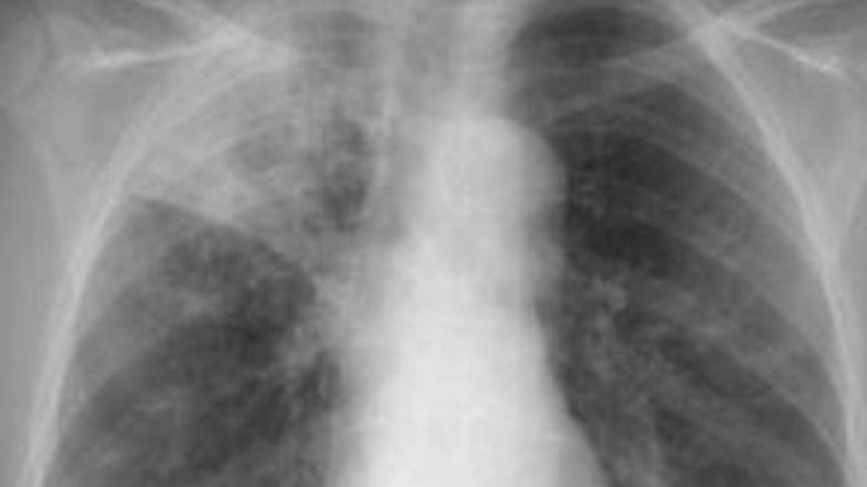 الطاعون الأبيض يحصد 73 ضحية بباتنة والقائمة مفتوحة