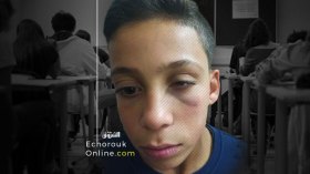 أستاذ يعتدي على تلميذ ويدخله المستشفى بباتنة