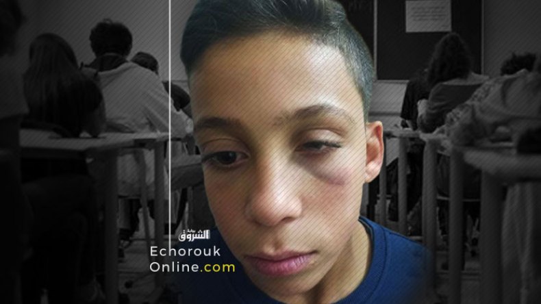 أستاذ يعتدي على تلميذ ويدخله المستشفى بباتنة