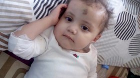 “سرطان الدم” يفتك بابنتي “ريحان” .. وهذه قصتي مع العذاب