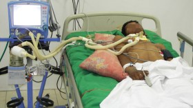 جزائري يموت كل 10 دقائق بسبب السكتة الدماغية