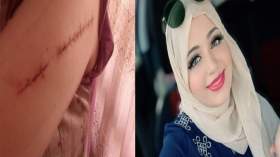 عبير بن رابح: هذا ما فعله المجرمون بي ولن أتراجع