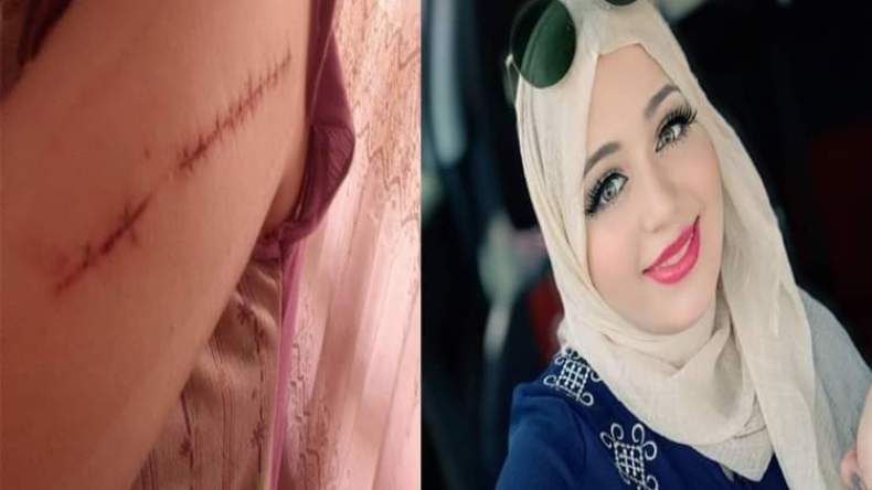 عبير بن رابح: هذا ما فعله المجرمون بي ولن أتراجع