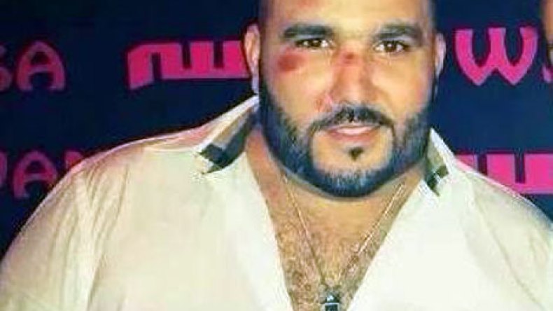 بالصُور: اعتداء وحشي على الشاب رضا الطالياني بأحد ملاهي ألمانيا