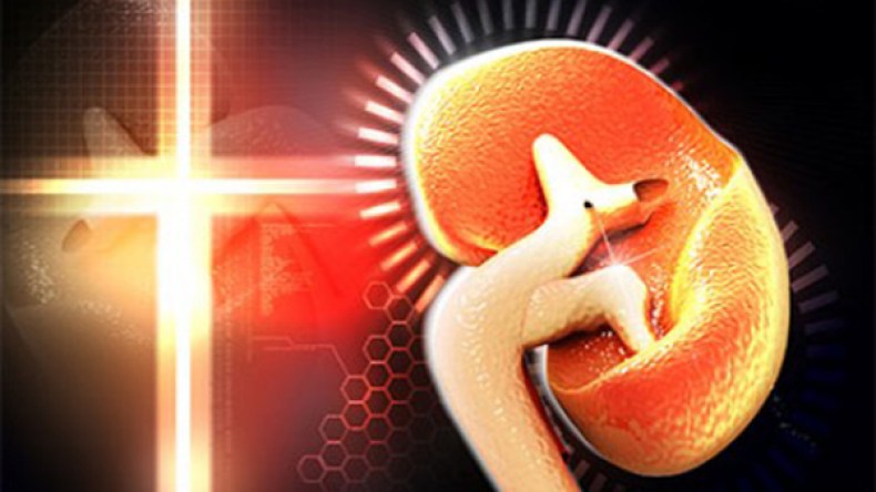 مرضى الكلى والصوم