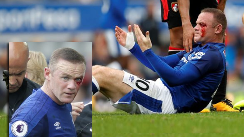 “الدماء” تنهي أسبوعا كارثيا لروني