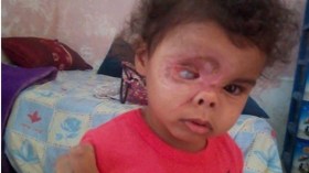 من ينقذ ساجدة من التشوه مدى الحياة؟