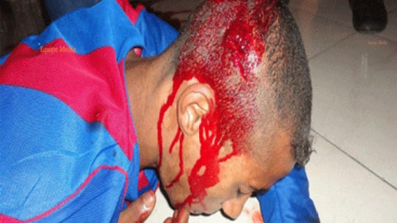 الصحراء الغربية: عشرات المصابين في مظاهرات سلمية بالعيون المحتلة