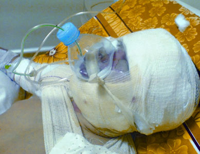 La Santé dans le coma  en Algérie