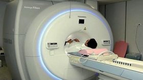 تسجيل 130 حالة سرطان جديدة لكل 100 ألف شخص سنويا في الجزائر