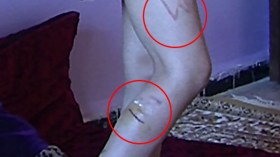 طفل “يتعرض للتعذيب” بمنزله في تبسة ويرفض مغادرته منذ سنتين