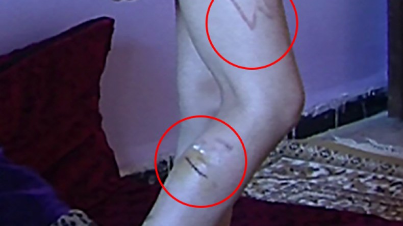 طفل “يتعرض للتعذيب” بمنزله في تبسة ويرفض مغادرته منذ سنتين