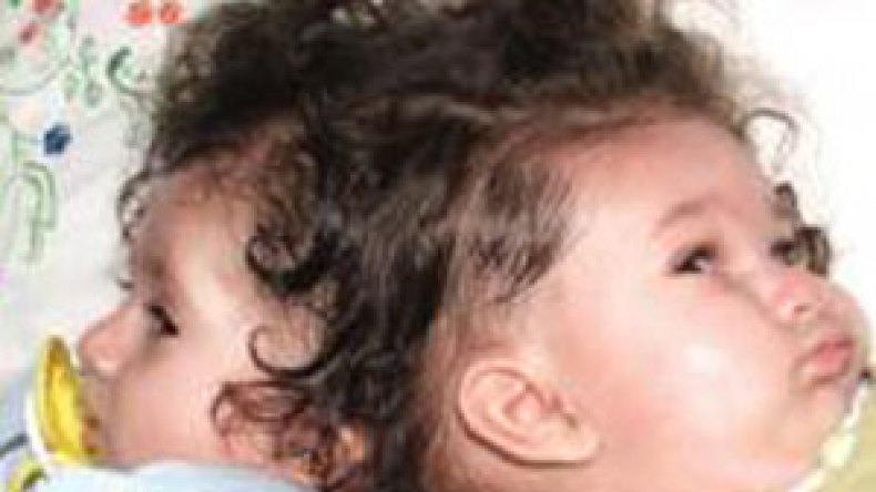 بعد‭ ‬‮”‬الصحة‮”‬‭ ‬وزارة‭ ‬العمل‭ ‬تتماطل‭ ‬في‭ ‬تحويل‭ ‬التوأم‭ ‬السيامي‭ ‬للعلاج‭ ‬بالخارج