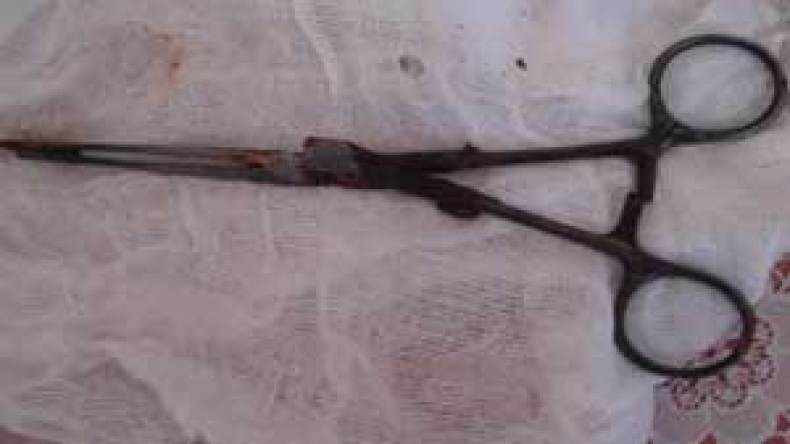 استخراج‮ ‬مقص‮ ‬من‮ ‬بطن‮ ‬امرأة‮ ‬بعد‮ ‬خمس‮ ‬سنوات‮ ‬بباتنة