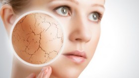 بشرتي جافة ومترهلة في فصل الصيف… ماذا أفعل؟