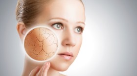 احذري تشقق البشرة في الشتاء (الصرّ)!