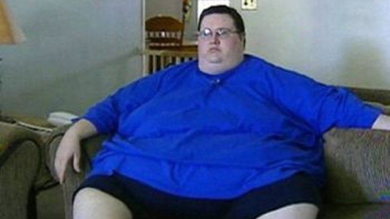 مستشفى اسكتلندي يمنع دخول الأشخاص البدناء