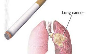 Smoking to kill 520 million smokers by 2050, Doctors warn