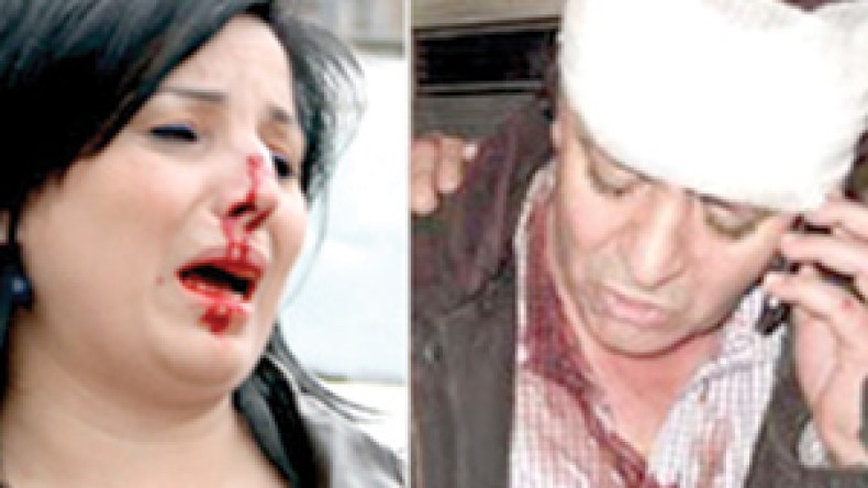 فنانو‭ ‬‮”‬الأسد‮”‬‭ ‬يتعرضون‭ ‬للضرب‭ ‬المبرح‭ ‬على‭ ‬يد‭ ‬معارضيه‭ ‬بالقاهرة‭ ‬