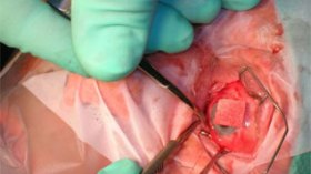 Human organs trade networks target less than 8-year-old children in Algeria