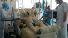 لاجئ سوري بلبنان يحاول الانتحار حرقا