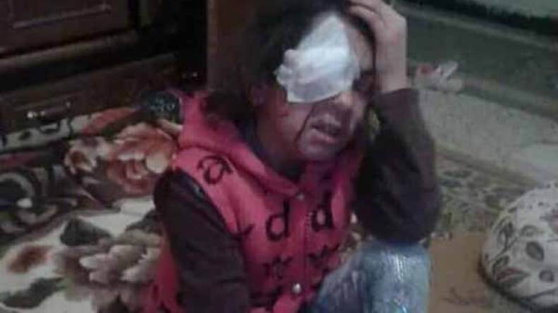 وفاة الطفلة لميس بعد سنة من طرح قضيتها على صفحات “الشروق” بباتنة