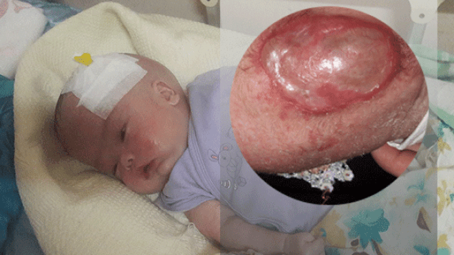 الملاك “تقوى” بباتنة في حاجة إلى مليار و300 مليون لإنقاذ حياتها