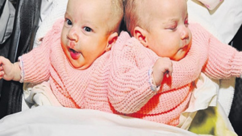 التوأم سارة وإكرام تغادران مفصولتين إلى الجزائر