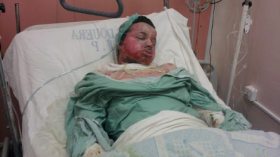 رفضوه زوجا فأحرق نفسه وتورّط في تحرش فرشّ جسده بالبنزين