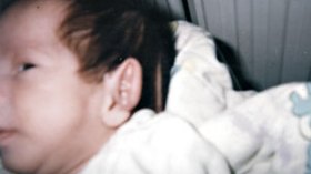 رضيع يفقد جزءا من أذنه في مستشفى القبة