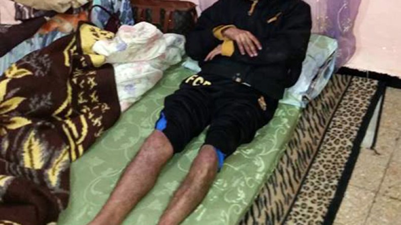 عبد القادر.. الأمل المشلول لأسرة معوزة