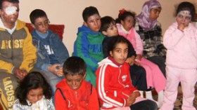 مرض خبيث يشوه وجوه المرضى ويقتلع أعينهم