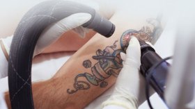 جزائريون يزيلون الوشم طلبا لدخول “الجنة”