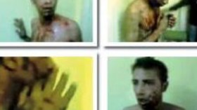 حقوقيون يتحركون لفتح تحقيق حول تعذيب شاب من قبل مرتزقة مصريين