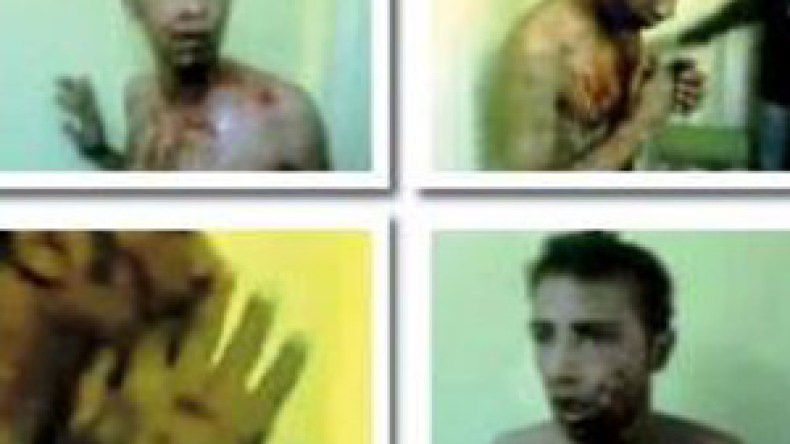 حقوقيون يتحركون لفتح تحقيق حول تعذيب شاب من قبل مرتزقة مصريين