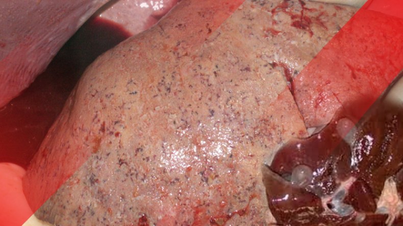 وزارة الصحة تحذر من انتشار الكيس المائي يوم العيد