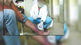 هاجس الحمى المالطية والتسمّم العقربي يطارد عشرات السكان بالمسيلة