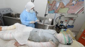 حروق الطبخ قتلت 100 جزائري منذ بداية رمضان