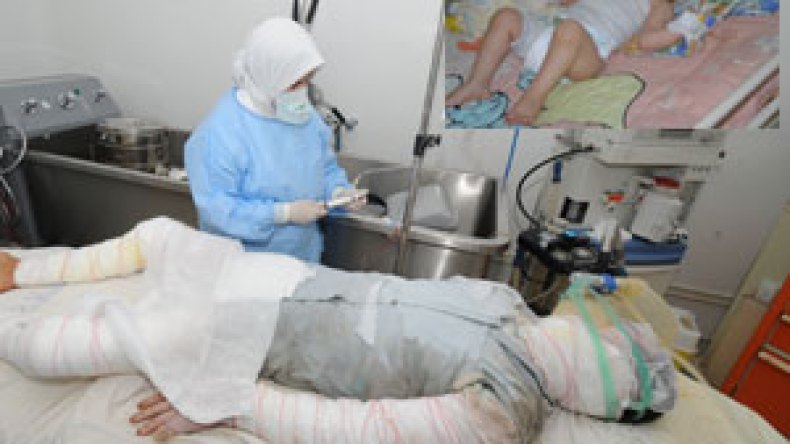 حروق الطبخ قتلت 100 جزائري منذ بداية رمضان