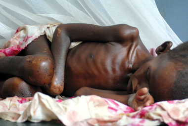 El-Irchad et Echorouk dépêchent une caravane d'aide humanitaire en Somalie