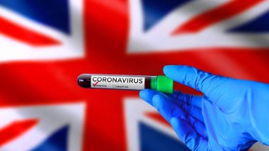 Pasteur: 7 nouveaux cas du variant britannique et 13 nouveaux cas du nigérien