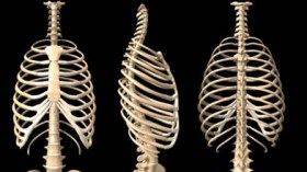 مرض تشوه النخاع الشوكي يهدد حياة المواليد في الجزائر